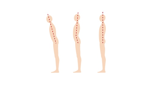 AI分析で骨盤・腰椎の歪みを可視化