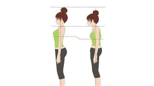 AI姿勢分析で身体の歪みを可視化